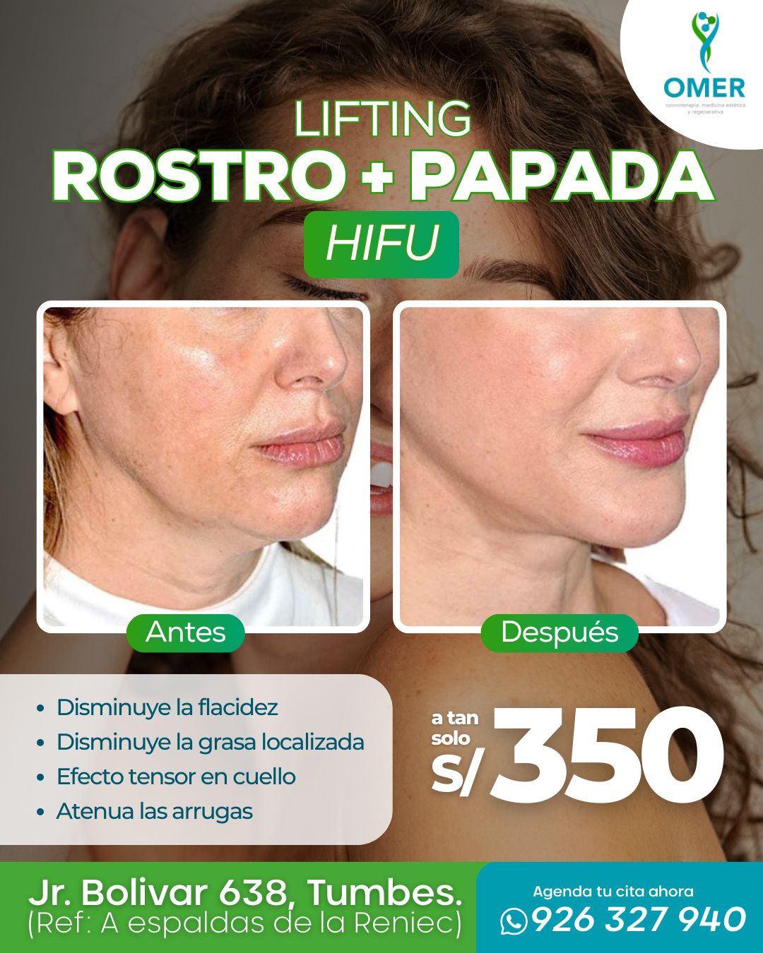 servicio